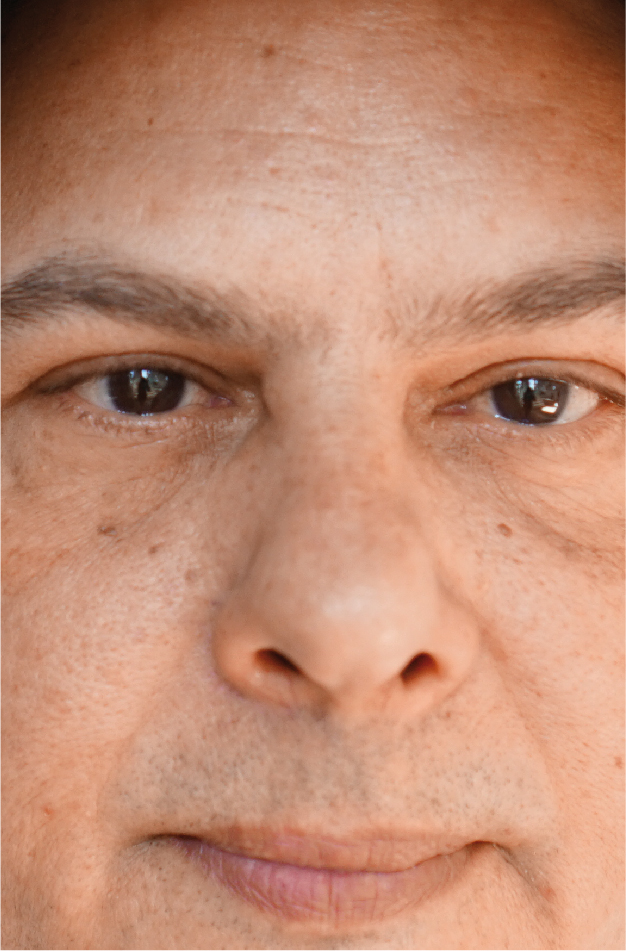 CASOS_FEBERERO-04